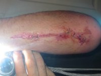 Random family photos a hole sewed up infected